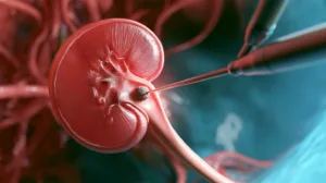 Treating Kidney Stones with a Tiny Camera: Ureteroscopy Explained